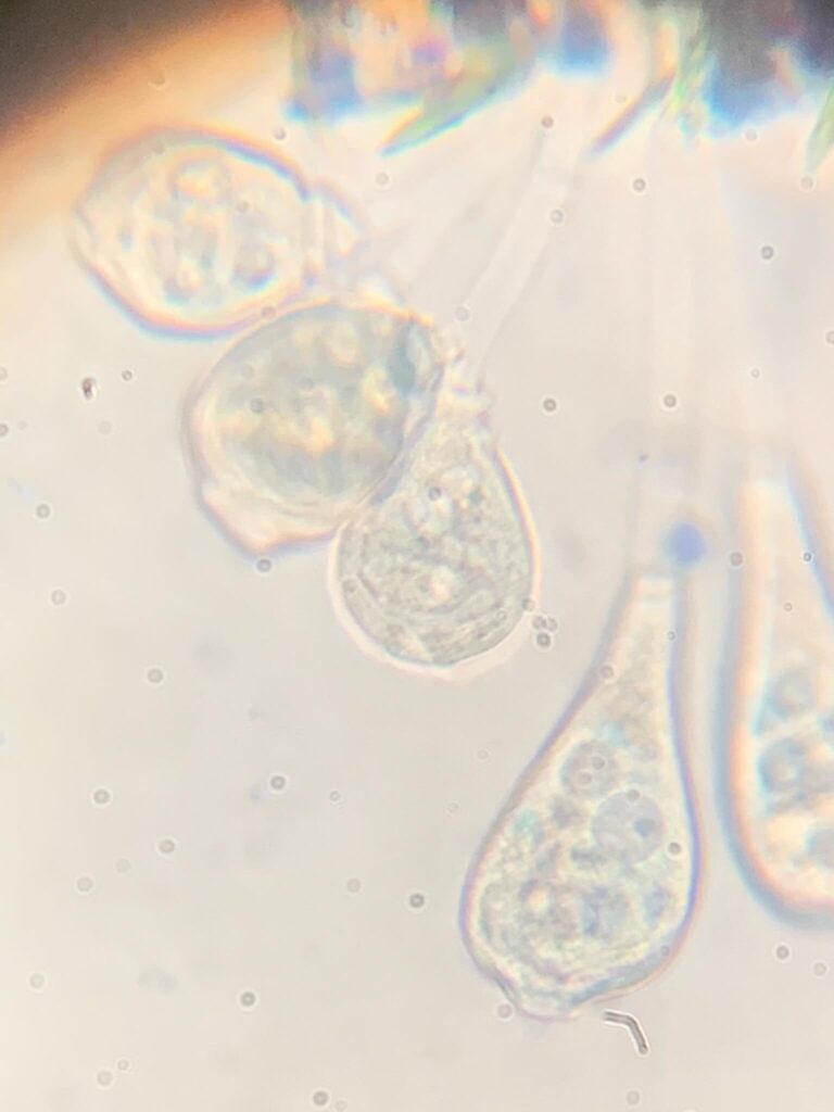 vorticella spp